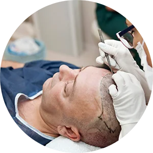 PRP / Exosomes at illumin8skin