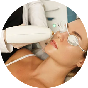 IPL Photofacial at illumin8skin