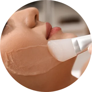 Chemical Peels